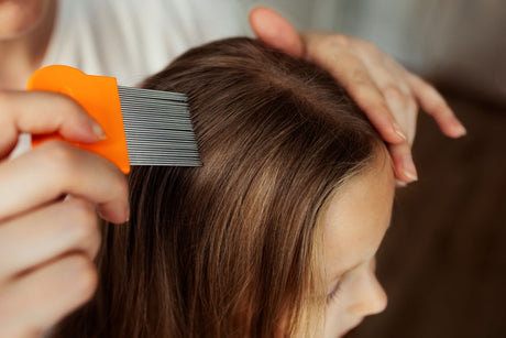 How to Get Rid of Head Lice: Effective Methods and Why It's Important for Hair Health